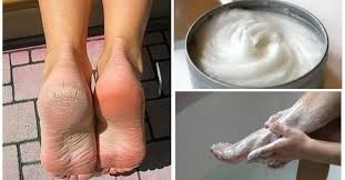 60MN CALLUS PEELING ( Spécial Callosités ) 